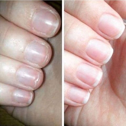 Dưỡng Móng Collagen Chắc Khỏe - Giúp Móng Nhanh Dài, Phục Hồi Móng Yếu, Sử Dụng Cho Tiệm Nail và Chăm Sóc Móng Tại Nhà