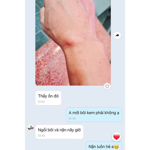Kem Bôi Tan U Mỡ Thảo Mộc Sumifun - Giảm Sưng Đau, Loại Bỏ U Lớn, Da Khỏe Mạnh Tự Nhiên, Chiết Xuất 9 Loại Thảo Mộc Quý