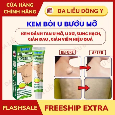 Kem Bôi Tan U Mỡ Thảo Mộc Sumifun - Giảm Sưng Đau, Loại Bỏ U Lớn, Da Khỏe Mạnh Tự Nhiên, Chiết Xuất 9 Loại Thảo Mộc Quý