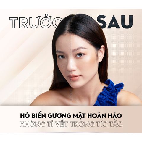 Kem Che Khuyết Điểm Đa Năng Catrice Allround 5 Màu 6g - Che Mụn, Thâm, Bọng Mắt, Tạo Khối, Lớp Nền Tự Nhiên