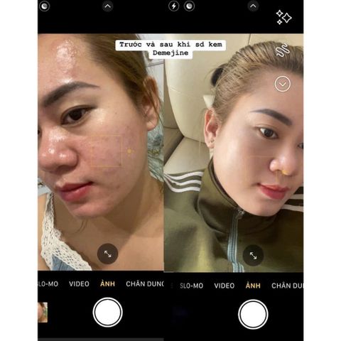 Kem Demejine Hàn Quốc - Kem Dưỡng Da Trắng Hồng, Ngày Đêm, Giảm Mụn Nám, Tái Tạo Da, Chống Lão Hóa - Sản Phẩm Chăm Sóc Da Đỉnh Cao 2024