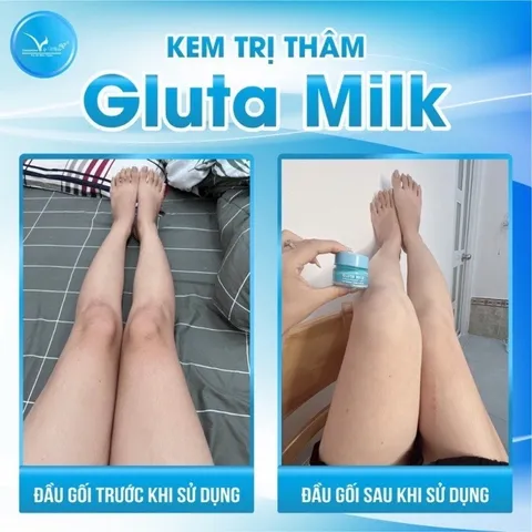 Kem Khử Thâm Nách Gluta Milk VIP White Thái Lan - Giảm Thâm, Làm Trắng Da, Khử Mùi, Hộp 15g - Mua 1 Tặng 1