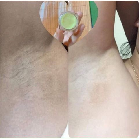 Combo 2 Hộp Kem Cô Bơ Khử Thâm Nách - Dưỡng Trắng & Giảm Mùi Hôi Hiệu Quả Cho Nam Nữ & Bà Bầu