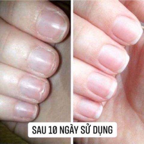 Dưỡng Móng Cứng Phục Hồi Móng Tay Chân Chắc Khỏe - Combo 2 Hũ 8gr Tăng Cường Độ Bóng, Giúp Móng Nhanh Dài, Chắc Khỏe