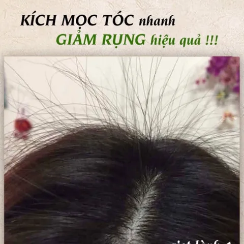 Xịt Dưỡng Tóc, Tinh Dầu Bưởi Mọc Tóc Thảo Mộc Xưa Kích Thích Mọc Tóc Con Giúp Tóc Nhanh Dài Giảm Gãy Rụng