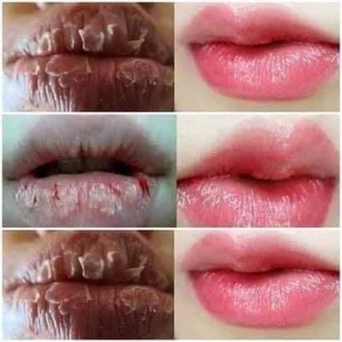 Son Dưỡng Môi Collagen Có Màu Cho Bà Bầu - Giảm Thâm Môi, Dưỡng Ẩm, Kích Màu Sau Phun Xăm, Chất Thiên Nhiên, Không Chì 2024