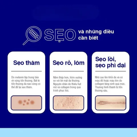 Kem Làm Mờ Sẹo Contractubex 20g - Dưỡng ẩm, Giảm Thâm, Cải Thiện Da Sau Tổn Thương, Đặc Trị Sẹo Lồi, Hàng Nội Địa Đức
