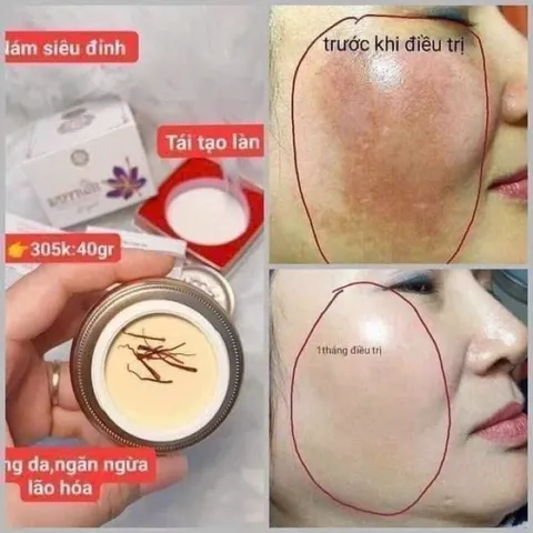 Kem Nám Tàn Nhang Saffron Hải Âu Việt - Dưỡng Trắng Da, Mờ Thâm, Ngừa Nám, 100% Tự Nhiên, Phục Hồi Làn Da Khỏe Đẹp