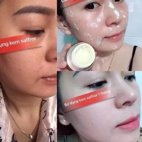 Kem Nám Tàn Nhang Saffron Hải Âu Việt - Dưỡng Trắng Da, Mờ Thâm, Ngừa Nám, 100% Tự Nhiên, Phục Hồi Làn Da Khỏe Đẹp