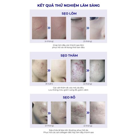 Combo 2 Lọ Cao Xoá Sẹo Collagen Mờ Sẹo Lồi Lõm - Giúp Nhanh Lành Vết Thương, Không Để Lại Sẹo cho Mẹ Bầu và Mẹ Bỉm