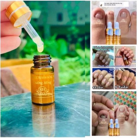 Combo 10 Serum Chống Nấm Móng & Hư Khoé - Giảm Đau & Hiệu Quả Nhanh 4ml, Phù Hợp Cho Nail Salon