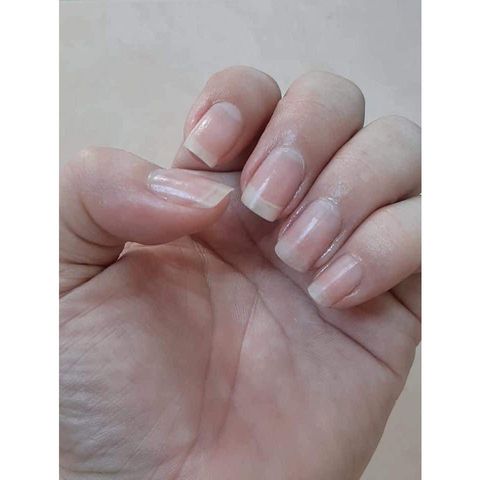 Combo Serum Nấm Móng và Kem Dưỡng Móng - Phục Hồi Móng Khỏe, Dài và Cứng, Giải Quyết Vấn Đề Nấm Móng Tay Chân