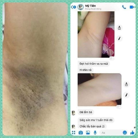 Kem Khử Mùi Hôi Nách Cô Bơ 30gr - Giảm Thâm, Ngăn Tiết Mồ Hôi, Dưỡng Trắng Da Từ Thiên Nhiên, Tiện Dụng Xuất Xứ Việt Nam