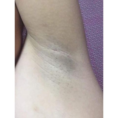 Kem Khử Mùi Hôi Nách Cô Bơ 30gr - Giảm Thâm, Ngăn Tiết Mồ Hôi, Dưỡng Trắng Da Từ Thiên Nhiên, Tiện Dụng Xuất Xứ Việt Nam