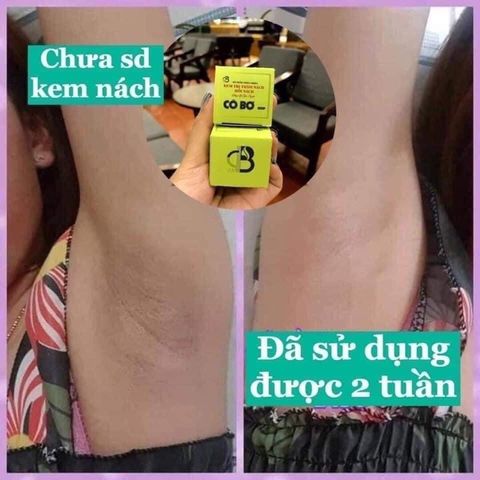 Kem Khử Mùi Hôi Nách Cô Bơ 30gr - Giảm Thâm, Ngăn Tiết Mồ Hôi, Dưỡng Trắng Da Từ Thiên Nhiên, Tiện Dụng Xuất Xứ Việt Nam