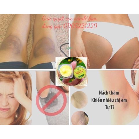 Kem Khử Mùi Hôi Nách Thâm Nách Cô Bơ 8gr -  Cho Mẹ Bầu & Mẹ Bỉm, Giảm Mồ Hôi & Làm Sáng Da Vùng Cánh Tay