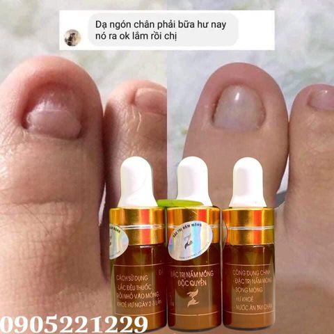 Serum Chăm Sóc Móng Tay Chân - Đánh Bay Nấm Móng, Hư Khóe, Bọng Móng, Phục Hồi Móng Mềm, Dinh Dưỡng Cho Móng 4ml