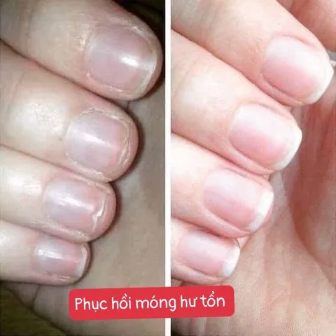 Hũ Dưỡng Móng Cứng Collagen - Phục Hồi Móng Tay Chân Khỏe Đẹp, Giúp Móng Dài, Bóng Hồng, Chống Nấm Móng và Hư Khóe