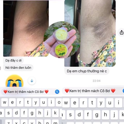 Combo 4 Hộp Kem Khử Hôi Nách Thâm Nách Cô Bơ - Giải Pháp An Toàn, Hiệu Quả Giúp Sáng Da Dưới Cánh Tay, 30000 Người Đã Khỏi Hẳn