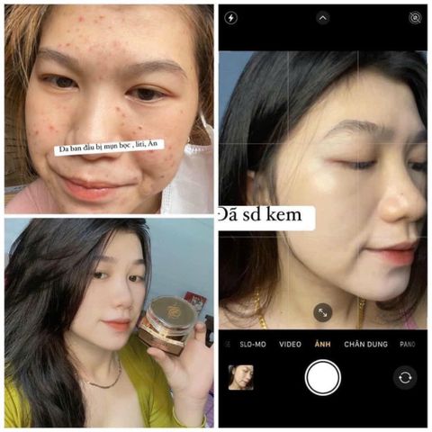 Kem Dưỡng Trắng Da Demejine Hàn Quốc - Mờ Thâm, Nám, Se Khít Lỗ Chân Lông - Hộp 20g Bảo Vệ Da Chất Lượng Cao