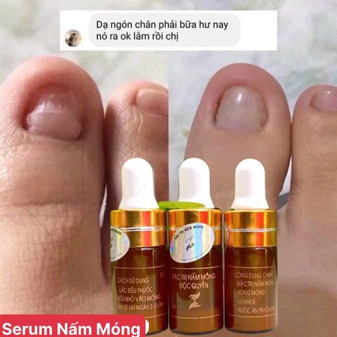 Combo 3 Chai Serum Chăm Sóc Móng Tay Chân - Trị Nấm Móng, Hư Khoé, Dưỡng Dài Móng Khỏe, 4ml