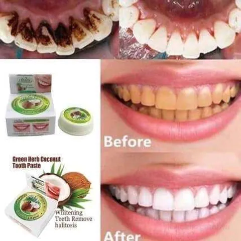 Kem Tẩy Trắng Răng Green Herb Thái Lan 25g - Giảm Ố Vàng, Sạch Vôi, An Toàn Tự Nhiên, Hơi Thở Thơm Mát - Gel Tẩy Trắng Răng