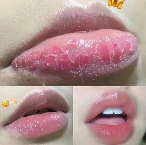 Set Tái Sinh Môi Mầm Gạo Lro’Cre - Khử Thâm, Dưỡng Ẩm và Làm Hồng Môi, Ngăn Khô Nẻ, Siêu Dưỡng Mềm Mại, Tẩy Da Chết Môi Chất Lượng Cao