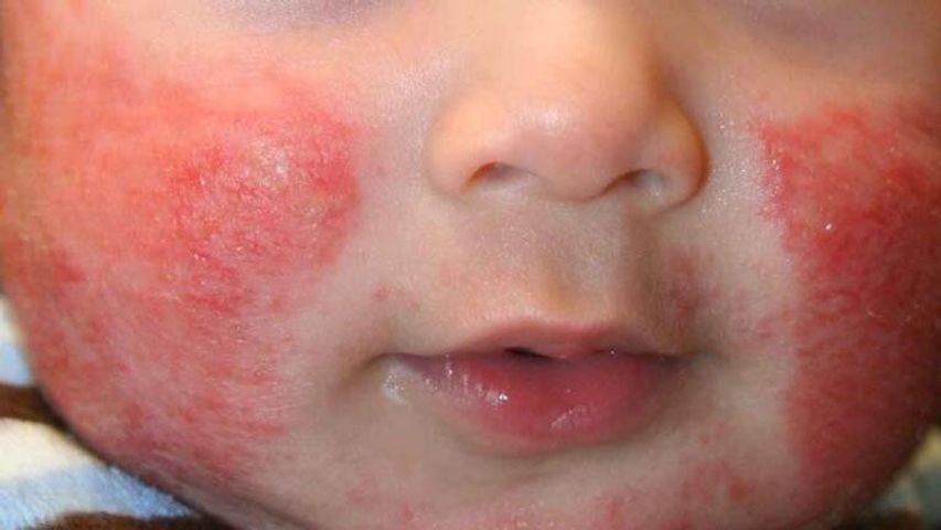 Kem Bôi Da Gia Truyền Thiên Di - Dưỡng Ẩm Da, Chữa Nứt Gót Chân, Chàm Sữa, An Toàn Cho Trẻ Sơ Sinh, Chiết Xuất Tự Nhiên
