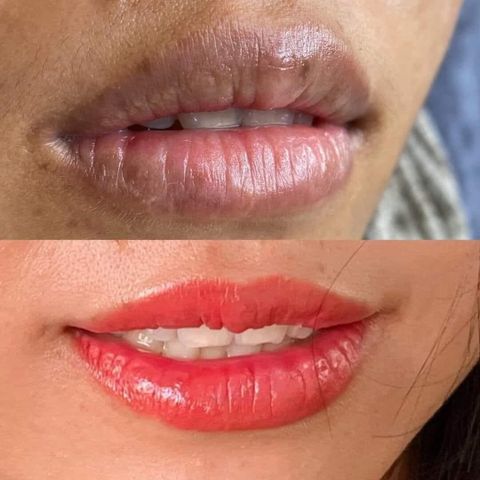 Combo Dưỡng Môi Collagen Thiên Di - Cấy Hồng Môi Giảm Thâm, Tự Nhiên Không Cần Phun Xăm, Mềm Mịn  - Làm Đẹp Da Môi