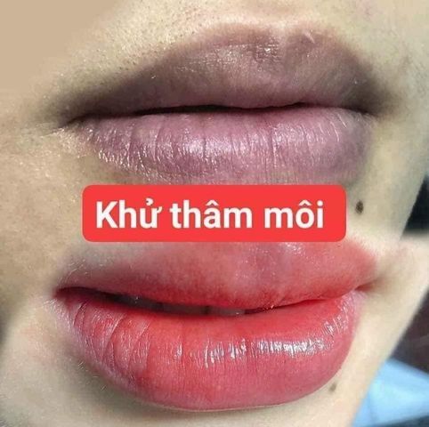 Combo Dưỡng Môi Collagen Thiên Di - Cấy Hồng Môi Giảm Thâm, Tự Nhiên Không Cần Phun Xăm, Mềm Mịn  - Làm Đẹp Da Môi