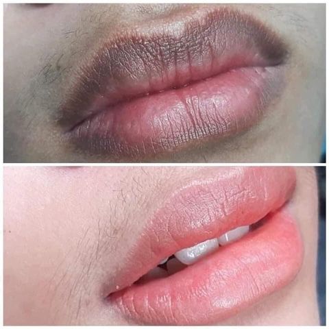 Combo Dưỡng Môi Collagen Thiên Di - Cấy Hồng Môi Giảm Thâm, Tự Nhiên Không Cần Phun Xăm, Mềm Mịn  - Làm Đẹp Da Môi
