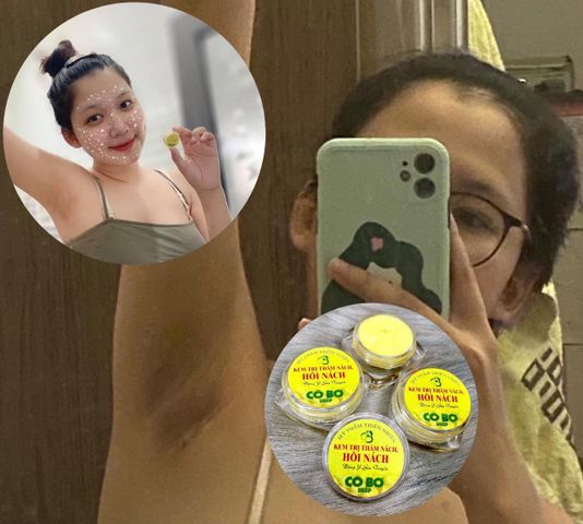 Combo 3 Hộp Kem Khử Mùi & Loại Bỏ Thâm Nách Cô Bơ - Giúp Da Mịn Màng, Không Mùi Hôi, Dùng Cho Mẹ Bầu & Mọi Đối Tượng