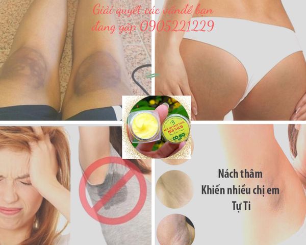 Combo Wax Lông Honey Spa và Kem Khử Thâm Nách - Giải Pháp Trắng Da, Khử Hôi, Dành Cho Nam Nữ, Chiết Xuất Thiên Nhiên