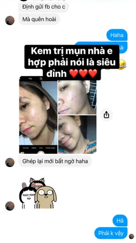 Kem Mụn Hoa Đào - Giải Pháp An Toàn Cho Da Sạch Mụn, Dưỡng Trắng Tự Nhiên, Phục Hồi Da Khô, Hiệu Quả Chỉ Sau 2 Tuần Sử Dụng