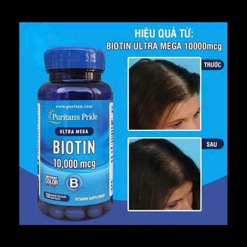 Viên uống mọc tóc Ultra Mega Biotin 10000mcg Puritan’s Pride 100 viên, nuôi tóc chắc khỏe