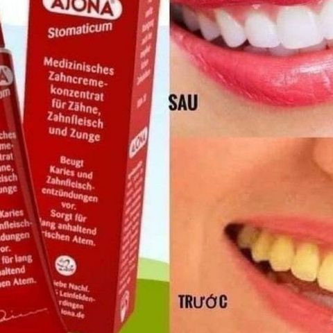 Kem Đánh Răng Ajona Đức 25ml - Giảm Hôi Miệng, Làm Sạch Sâu, Bảo Vệ Nướu, Dành Cho Người Uống Trà Cà Phê
