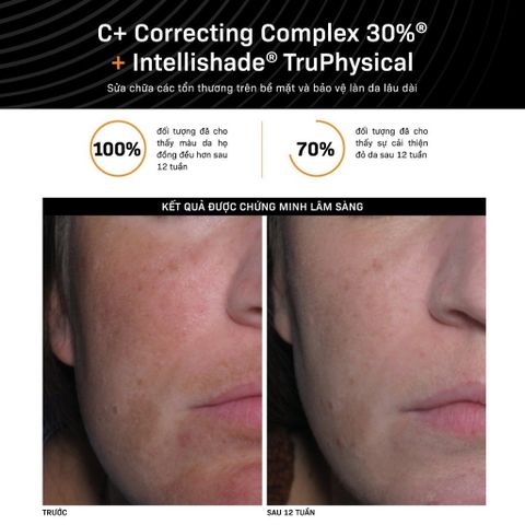 Serum Revision Skincare C+ Correcting Complex 30% Dưỡng Trắng Và làm Đều Màu Da