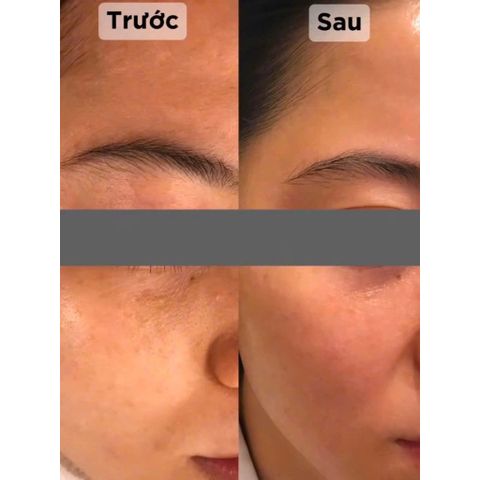 Kem Da Ban Ngày CASMARA Clarifying Anti-Aging Cream SPF50 50ML – Dưỡng Trắng Mờ Nám