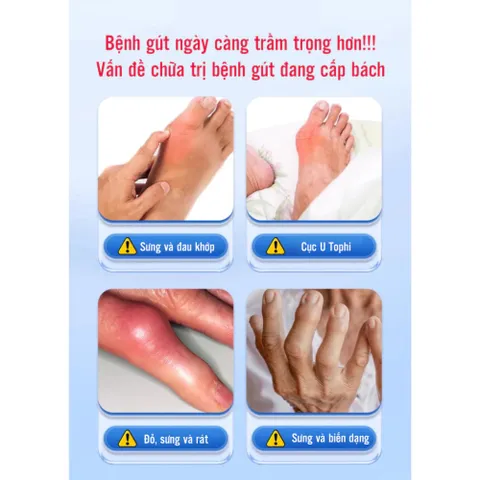Gel lạnh thoa giảm đau khớp - Cải thiện sưng viêm, đau nhức ngón tay, đầu gối, chân - Giải pháp tự nhiên hiệu quả cho sức khỏe
