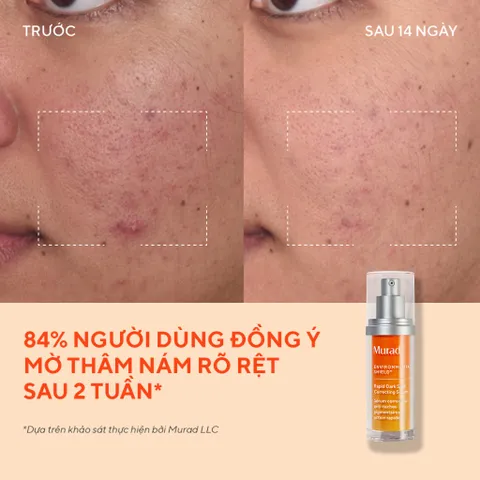 Tinh Chất Serum Murad Rapid Dark Spot Correcting 30ml -  Hỗ Trợ Mờ Nám, Tàn Nhang, Thâm Sạm