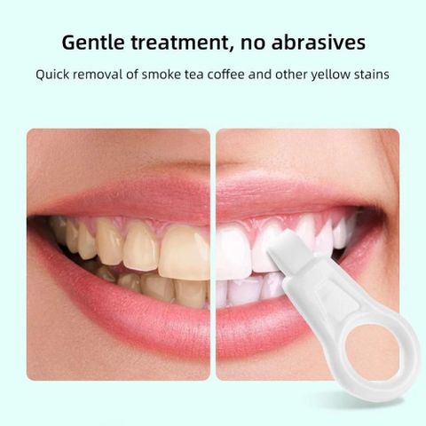 Bộ 3 Khăn Lau Làm Sạch Răng Trẻ Em - Loại Bỏ Tartar và Vết Bẩn, Miếng Bọt Biển An Toàn, Dễ Dàng Sử Dụng, Tiết Kiệm Chi Phí