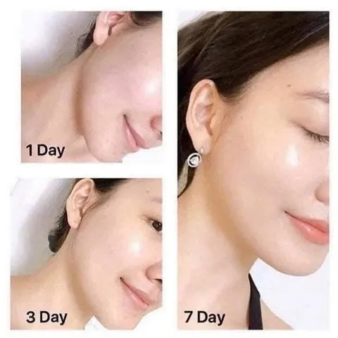 Serum Estée Lauder Perfectionist Pro Vitamin C 15ml - Sáng da, Chống oxy hóa, Phục hồi sức sống cho làn da mịn màng, Giúp luôn tươi trẻ