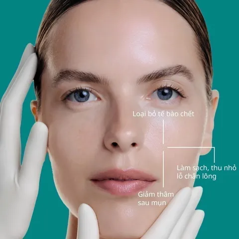 Toner BHA Obagi Clenziderm Pore Therapy 2% Salicylic Acid 148ml - Giảm Mụn, Làm Sạch Sâu, Chăm Sóc Da Dầu và Da Mụn