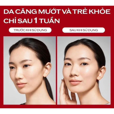 Nước Thần Đỏ Shiseido Eudermine 70ml - Essence Cấp Ẩm, Làm Mịn Da, Sáng Da, Dành Cho Mọi Loại Da