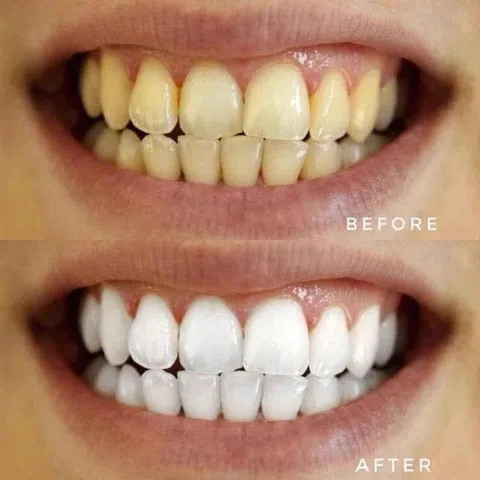 Set Kem đánh răng colgate Mỹ optic white hàng Mỹ