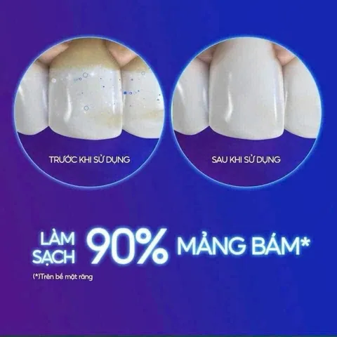 (HÀNG CHÍNH HÃNG MỸ)KEM ĐÁNH RĂNG CREST 3D WHITE ADVANCED  147g MỸ