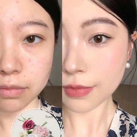 Phấn nước Ohui Ultimate Cover Lifting Cushion – nâng tone, che tốt