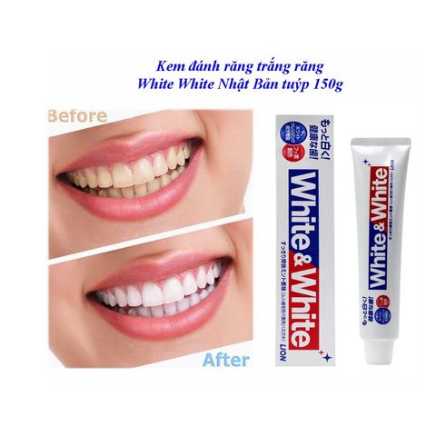 Kem Đánh Răng Nhật Bản White & White Lion 150g - Làm Trắng Răng, Diệt Khuẩn, Hương Bạc Hà Tươi Mát, Sáng Bóng, An Toàn cho Nướu nhạy cảm