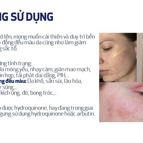 [MẪU MỚI] Lotion Dưỡng Trắng Sáng Da Mờ Thâm Nám Obagi Suzanobagimd Claribright nhập khẩu chính hãng