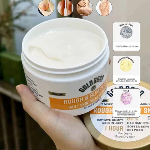 Kem Dưỡng Gold Bond Rough & Bumpy 228g - Làm Mềm Da, Giảm Tình Trạng Sần Sùi, Dưỡng Ẩm Sâu, Phục Hồi Da Khỏe Mạnh